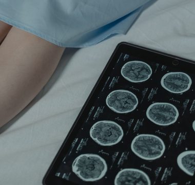 Yapay Zeka, Kanseri 1 Yıl Önceden %90 Hassasiyetle Tespit Ediyor