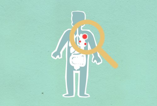 Yakın Doğu Üniversitesi’nden Küresel Salgın İzleme Portalı 25 Hastalığı Anlık Takip Ediyor