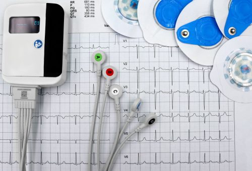 Queen of Hearts Yapay Zekası Kalp Krizi Teşhisinde FDA Onayı Aldı