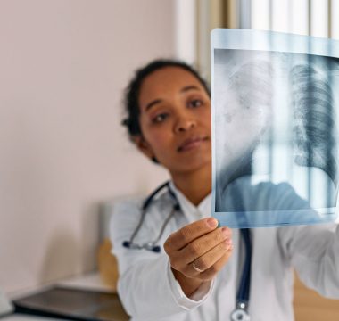 Yapay zeka akciğer kanserini %95,7 doğrulukla erken saptadı