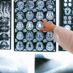 Neuralink, 50.000 Saat Veriyle BCI Rekoru Kırdı: Felçli Hasta “Seni Seviyorum” Dedi