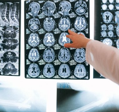Neuralink, 50.000 Saat Veriyle BCI Rekoru Kırdı: Felçli Hasta “Seni Seviyorum” Dedi