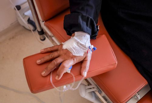 Tek Doz CRISPR Tedavisi GSDIa Hastalarında Glukoz Üretimini %500 Artırdı</strong