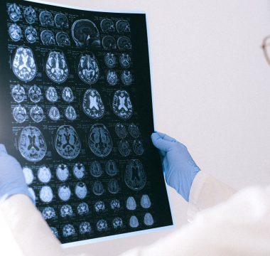 Nörogeribildirim Opioid Bağımlılığında Relapsı %65 Azalttı